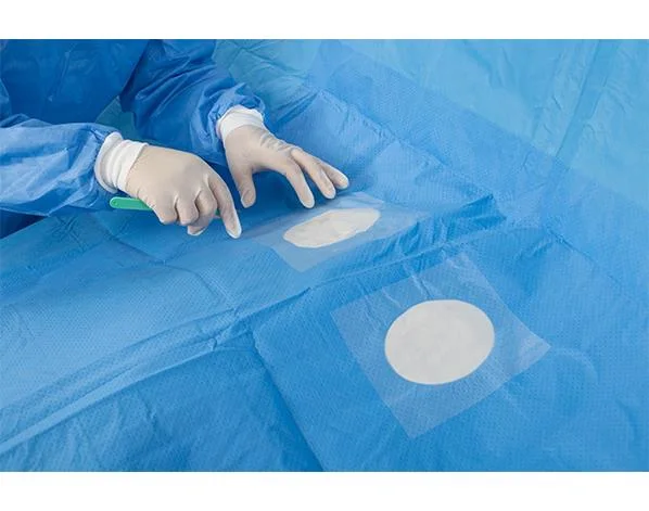 Sterile Medical Disposable Surgical Drapes for Angiography Surgery